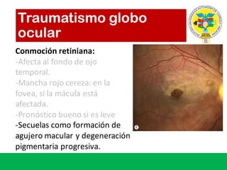 Traumatismo globo
ocular
Conmoción retiniana:	
-Afecta al	fondo de	ojo
temporal.
-Mancha	rojo cereza:	en	la	
fovea,	si la	mácula está
afectada.
-Pronóstico bueno si es leve
-Secuelas como formación de	
agujero macular	y	degeneración
pigmentaria progresiva.
 