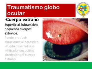 -Cuerpo extraño
Superficial	Subtarsales:	
pequeños cuerpos
extraños.
Puede producir
abraciones al	parpadeo.
-Puede desarrollarse
inflitrado leucocítico
alrededor del	cuerpo
extraño.
Traumatismo globo
ocular
 