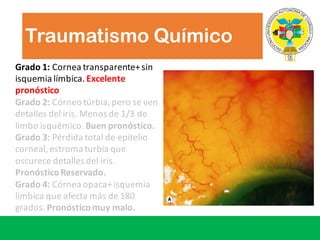 Traumatismo Químico
Grado	1: Cornea	transparente+	sin	
isquemia	límbica.	Excelente
pronóstico
Grado 2:	Córneo túrbia,	pero se	ven
detalles del	iris.	Menos de	1/3	de	
limbo	isquémico.	Buen pronóstico.
Grado 3: Pérdida total	de	epitelio
corneal,	estroma turbia que
oscurece detalles del	iris.	
PronósticoReservado.
Grado 4:	Córnea opaca+	isquemia
límbica que afecta más de	180	
grados.	Pronósticomuy malo.
 