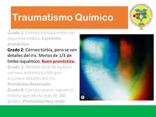 Traumatismo Químico
Grado	1: Cornea	transparente+	sin	
isquemia	límbica.	Excelente
pronóstico
Grado 2:	Córneo túrbia,	pero se	ven
detalles del	iris.	Menos de	1/3	de	
limbo	isquémico.	Buen pronóstico.
Grado 3: Pérdida total	de	epitelio
corneal,	estroma turbia que
oscurece detalles del	iris.	
PronósticoReservado.
Grado 4:	Córnea opaca+	isquemia
límbica que afecta más de	180	
grados.	Pronósticomuy malo.
 