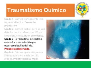 Traumatismo Químico
Grado	1: Cornea	transparente+	sin	
isquemia	límbica.	Excelente
pronóstico
Grado 2:	Córneo túrbia,	pero se	ven
detalles del	iris.	Menos de	1/3	de	
limbo	isquémico.	Buen pronóstico.
Grado 3: Pérdida total	de	epitelio
corneal,	estroma turbia que
oscurece detalles del	iris.	
PronósticoReservado.
Grado 4:	Córnea opaca+	isquemia
límbica que afecta más de	180	
grados.	Pronósticomuy malo.
 