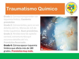 Traumatismo Químico
Grado	1: Cornea	transparente+	sin	
isquemia	límbica.	Excelente
pronóstico
Grado 2:	Córneo túrbia,	pero se	ven
detalles del	iris.	Menos de	1/3	de	
limbo	isquémico.	Buen pronóstico.
Grado 3: Pérdida total	de	epitelio
corneal,	estroma turbia que
oscurece detalles del	iris.	
PronósticoReservado.
Grado 4:	Córnea opaca+	isquemia
límbica que afecta más de	180	
grados.	Pronósticomuy malo.
 