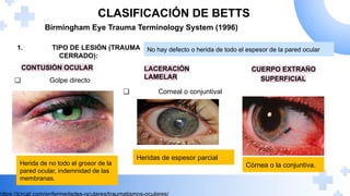 Betts Classification TRAUMATISMO OOCULAR, fracturas de orbita, quemaduras fisicas y quimicas ...