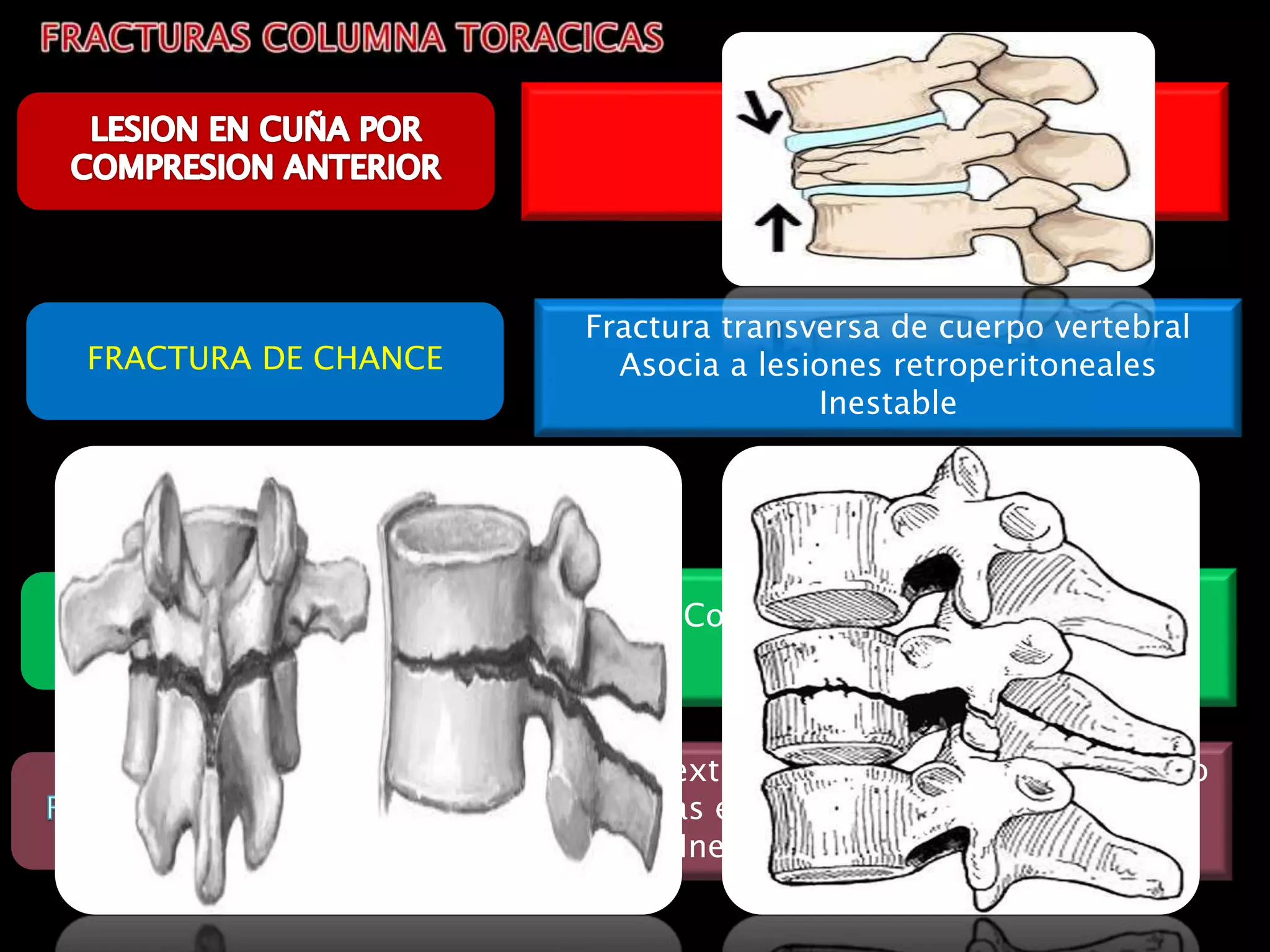 Lesiones Raras Traumatismo raquimedular | PPTX