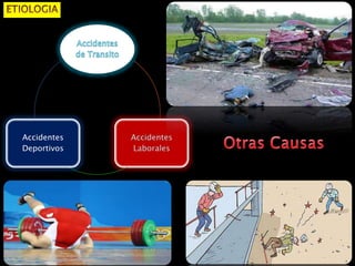 Accidentes
Deportivos
 