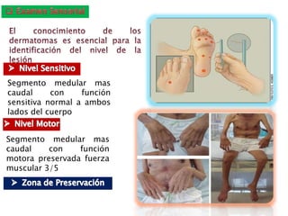Segmento medular mas
caudal con función
sensitiva normal a ambos
lados del cuerpo
Segmento medular mas
caudal con función
motora preservada fuerza
muscular 3/5
 