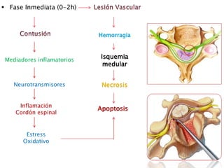  Fase Inmediata (0-2h)
Mediadores inflamatorios
Neurotransmisores
Inflamación
Cordón espinal
Estress
Oxidativo
Isquemia
medular
Necrosis
Hemorragia
Apoptosis
 