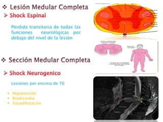 Perdida transitoria de todas las
funciones neurológicas por
debajo del nivel de la lesión
 Hipotensión
 Bradicardia
 Vasodilatación
Lesiones por encima de T6
 