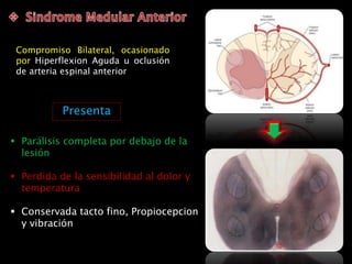 Compromiso Bilateral, ocasionado
por Hiperflexion Aguda u oclusión
de arteria espinal anterior
 Parálisis completa por debajo de la
lesión
 Perdida de la sensibilidad al dolor y
temperatura
 Conservada tacto fino, Propiocepcion
y vibración
Presenta
 
