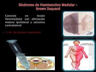 Consiste en lesión
Hemimedular con afectación
motora ipsilateral y sensitiva
contralateral
 2-4% de lesiones traumáticas
 