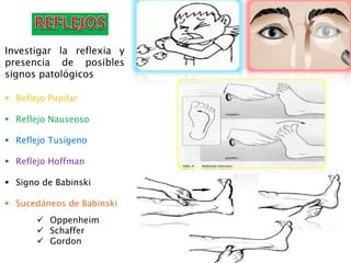 Investigar la reflexia y
presencia de posibles
signos patológicos
 Reflejo Pupilar
 Reflejo Nauseoso
 Reflejo Tusígeno
 Reflejo Hoffman
 Signo de Babinski
 Sucedáneos de Babinski
 Oppenheim
 Schaffer
 Gordon
 