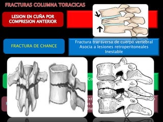 Sobrecarga Axial
LESION POR
ESTALLAMIENTO
Compresión Axial Vertical
Inestables
FRACTURA DE CHANCE
Fractura transversa de cuerpo vertebral
Asocia a lesiones retroperitoneales
Inestable
Flexión extrema o un traumatismo cerrado
Raras en región torácica y lumbar
Inestable Déficit completa
 