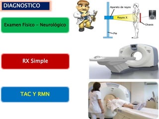 DIAGNOSTICO
Examen Físico - Neurológico
RX Simple
TAC Y RMN
 