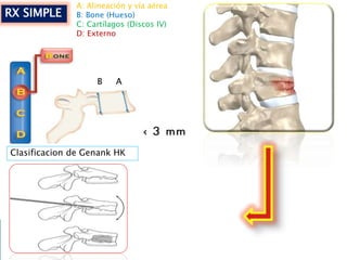 RX SIMPLE
A: Alineación y vía aérea
B: Bone (Hueso)
C: Cartílagos (Discos IV)
D: Externo
AB
Clasificacion de Genank HK
 