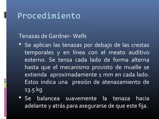 Procedimiento
Tenazas de Gardner- Wells
 Se aplican las tenazas por debajo de las crestas
temporales y en línea con el meato auditivo
externo. Se tensa cada lado de forma alterna
hasta que el mecanismo provisto de muelle se
extienda aproximadamente 1 mm en cada lado.
Estos indica una presión de atenazamiento de
13.5 kg
 Se balancea suavemente la tenaza hacia
adelante y atrás para asegurarse de que este fija.
 