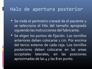 Halo de apertura posterior
 Se mide el perímetro craneal de el paciente y
se selecciona el hilo del tamaño apropiado
siguiendo las instrucciones del fabricante.
 Se eligen los puntos de fijación. Los tornillos
anteriores deben colocarse 1 cm. Por encima
del tercio externo de cada ceja. Los tornillos
posteriores deben colocarse en las areas
occipitales laterales, en las posiciones
aproximadas de las 4 y las 8 en punto.
 