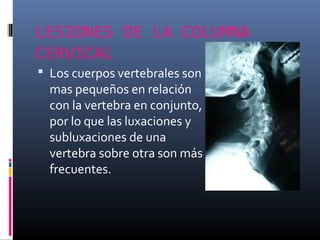 LESIONES DE LA COLUMNA
CERVICAL
 Los cuerpos vertebrales son
mas pequeños en relación
con la vertebra en conjunto,
por lo que las luxaciones y
subluxaciones de una
vertebra sobre otra son más
frecuentes.
 