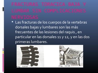 FRACTURAS TORACICA BAJA Y
LUMBAR SIN COMPLICACIONES
NERVIOSAS
 Las fracturas de los cuerpos de la vertebras
dorsales bajas y lumbares son las más
frecuentes de las lesiones del raquis , en
particular en las dorsales 11 y 12, y en las dos
primeras lumbares.
 