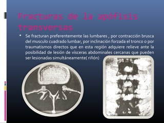 Fracturas de la apófisis
transversas
 Se fracturan preferentemente las lumbares , por contracción brusca
del musculo cuadrado lumbar, por inclinación forzada el tronco o por
traumatismos directos que en esta región adquiere relieve ante la
posibilidad de lesión de vísceras abdominales cercanas que pueden
ser lesionadas simultáneamente( riñón)
 