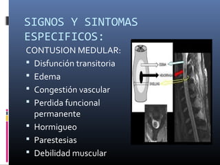 SIGNOS Y SINTOMAS
ESPECIFICOS:
CONTUSION MEDULAR:
 Disfunción transitoria
 Edema
 Congestión vascular
 Perdida funcional
permanente
 Hormigueo
 Parestesias
 Debilidad muscular
 