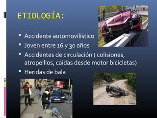 ETIOLOGÍA:
 Accidente automovilístico
 Joven entre 16 y 30 años
 Accidentes de circulación ( colisiones,
atropelllos, caidas desde motor bicicletas)
 Heridas de bala
 