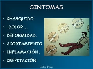 SINTOMAS
• CHASQUIDO.

• DOLOR .

• DEFORMIDAD.

• ACORTAMIENTO.

• INFLAMACIÓN.

• CREPITACIÓN
                Carlos Piquer
 