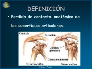 DEFINICIÓN
• Perdida de contacto anatómico de

 las superficies articulares.




               Carlos Piquer
 