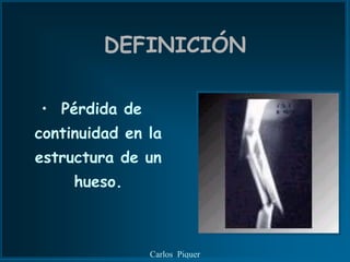DEFINICIÓN

• Pérdida de
continuidad en la
estructura de un
     hueso.



               Carlos Piquer
 