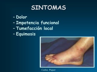 SINTOMAS
– Dolor
– Impotencia funcional
– Tumefacción local
– Equimosis




             Carlos Piquer
 