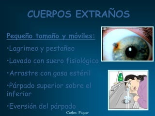 CUERPOS EXTRAÑOS

Pequeño tamaño y móviles:
•Lagrimeo y pestañeo
•Lavado con suero fisiológico
•Arrastre con gasa estéril
•Párpado superior sobre el
inferior
•Eversión del párpado
                  Carlos Piquer
 