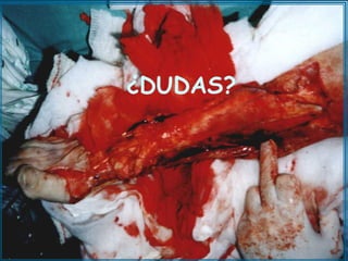 ¿DUDAS?




 Carlos Piquer
 