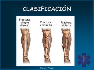 CLASIFICACIÓN




    Carlos Piquer
 