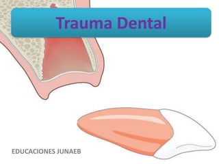 Trauma Dental
EDUCACIONES JUNAEB
 