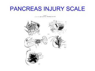 PANCREAS INJURY SCALE 