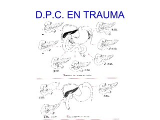 D.P.C. EN TRAUMA 