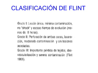 CLASIFICACIÓN DE FLINT 