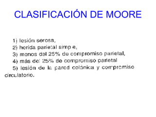 CLASIFICACIÓN DE MOORE 