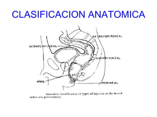 CLASIFICACION ANATOMICA 