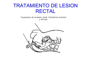 TRATAMIENTO DE LESION RECTAL 