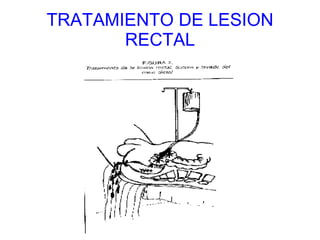 TRATAMIENTO DE LESION RECTAL 