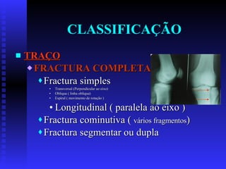 CLASSIFICAÇÃO TRAÇO FRACTURA COMPLETA Fractura simples Transversal (Perpendicular ao eixo) Obliqua ( linha obliqua) Espiral ( movimento de rotação ) Longitudinal ( paralela ao eixo ) Fractura cominutiva (  vários fragmentos ) Fractura segmentar ou dupla 