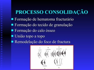 PROCESSO CONSOLIDAÇÃO Formação de hematoma fracturário Formação do tecido de granulação Formação do calo ósseo União topo a topo Remodelação do foco de fractura 