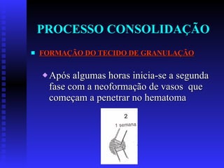 PROCESSO CONSOLIDAÇÃO FORMAÇÃO DO TECIDO DE GRANULAÇÃO Após algumas horas inicia-se a segunda fase com a neoformação de vasos  que começam a penetrar no hematoma 