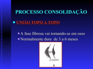 PROCESSO CONSOLIDAÇÃO UNIÃO TOPO A TOPO A fase fibrosa vai tornando-se em osso  Normalmente dura  de 3 a 6 meses 