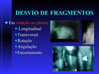 DESVIO DE FRAGMENTOS Em  relação ao plano : Longitudinal Transversal Rotação Angulação Encurtamento 