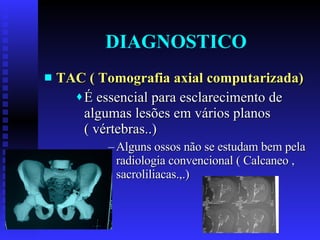 DIAGNOSTICO TAC ( Tomografia axial computarizada) É essencial para esclarecimento de algumas lesões em vários planos ( vértebras..) Alguns ossos não se estudam bem pela radiologia convencional ( Calcaneo , sacroliliacas.,.) 
