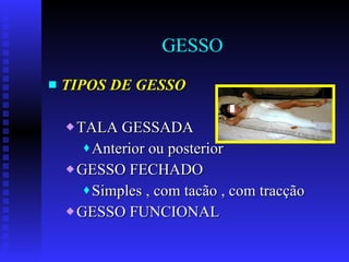 GESSO TIPOS DE GESSO TALA GESSADA Anterior ou posterior GESSO FECHADO Simples , com tacão , com tracção GESSO FUNCIONAL 