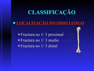 CLASSIFICAÇÃO LOCALIZAÇÃO NO OSSO LONGO Fractura no 1/ 3 proximal Fractura no 1/ 3 medio Fractura no 1/ 3 distal 