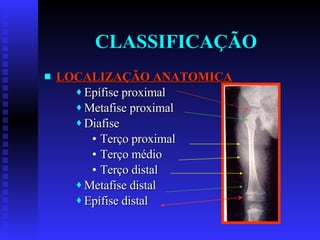 CLASSIFICAÇÃO LOCALIZAÇÃO ANATOMICA Epífise proximal Metafise proximal Diafise Terço proximal Terço médio Terço distal Metafise distal Epífise distal 