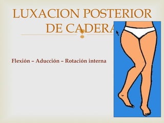 LUXACION POSTERIOR 
DE CADERA 
 
Flexión – Aducción – Rotación interna 
 